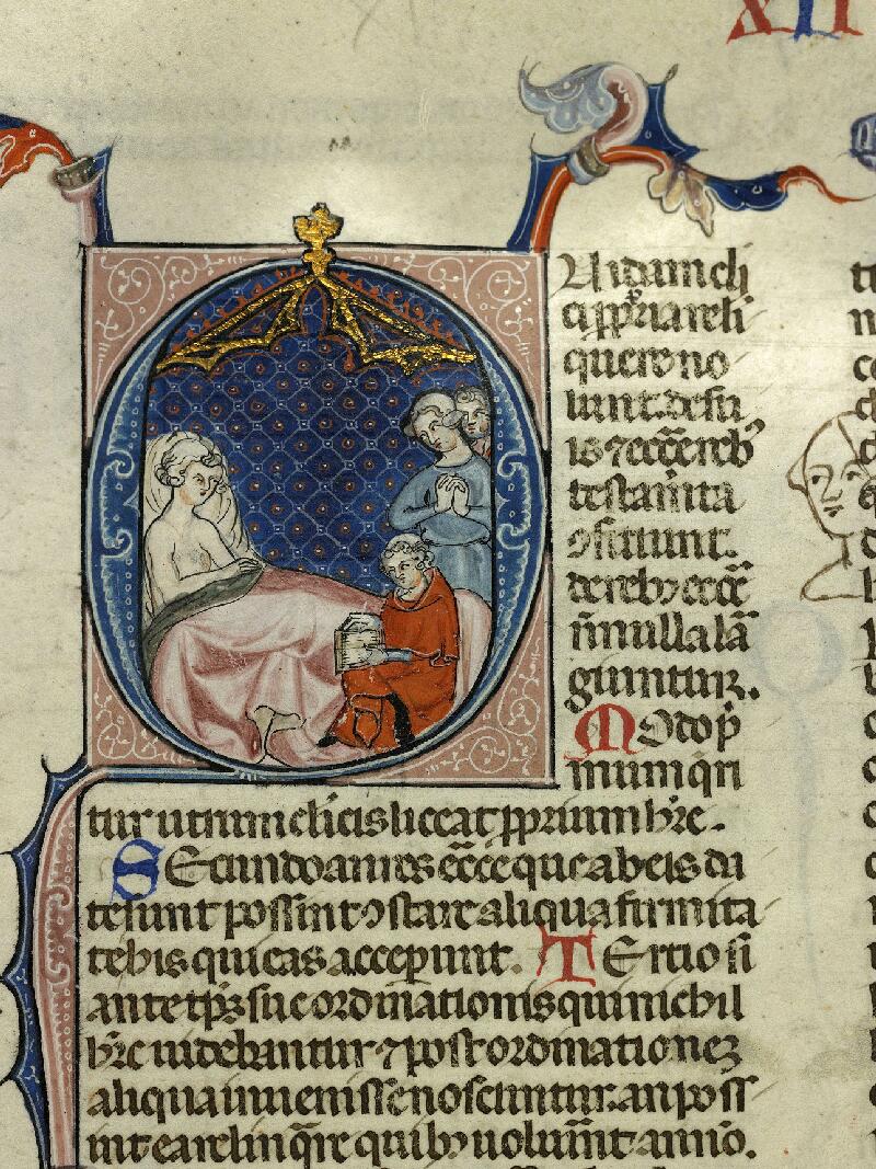 Cambrai, Bibl. mun., ms. 0605, f. 149 - vue 1