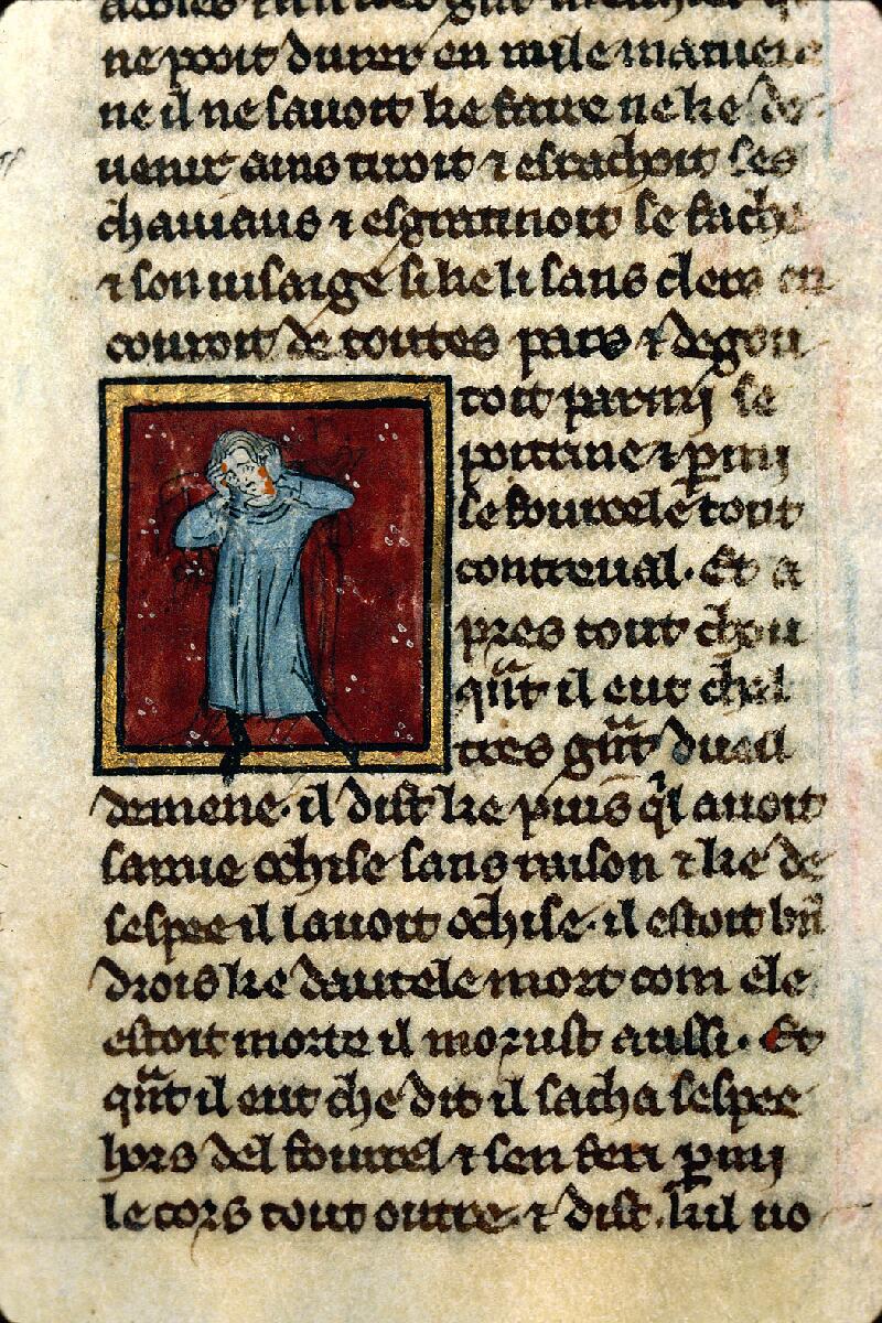 Dijon, Bibl. mun., ms. 0526, f. 010 - vue 3