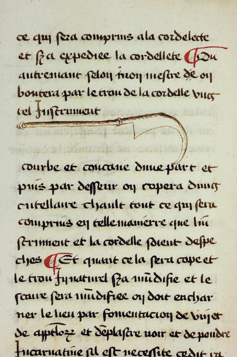 Montpellier, B. u. Médecine, H 184, f. 160v - vue 2